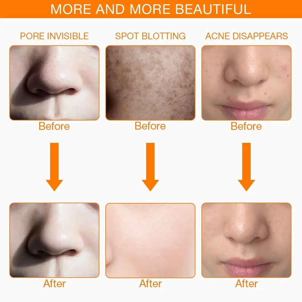 Evora Radiance Elite™